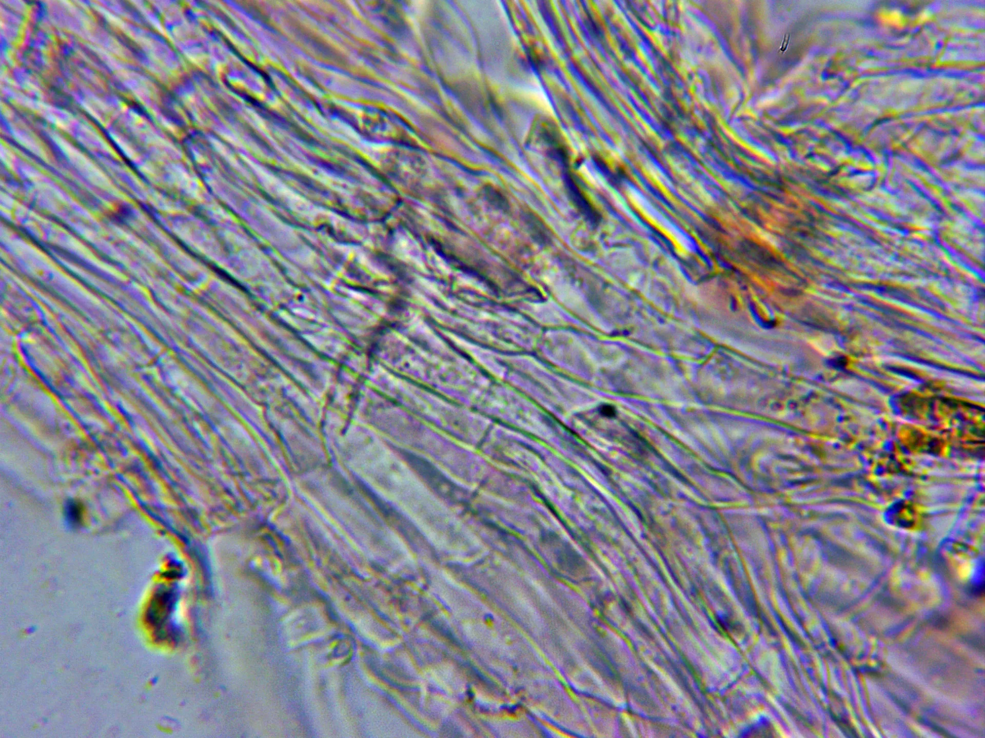 Microscopía de Ramaria flava - 11 - Hifas